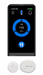 ilet with dexcom and libra